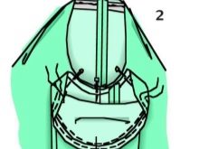 Sewing in sleeves - step 2