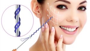 How to use threads for a facelift correctly?