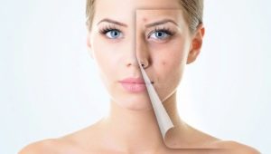 How to take care of problem skin?