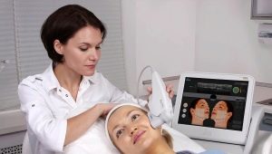 Features of the Ulthera System SMAS lifting