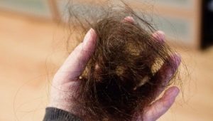 Hair falls out in bunches: causes and solution to the problem