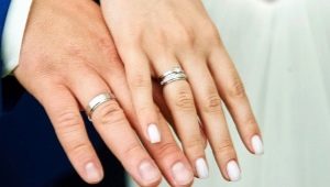 What are the samples of white gold?