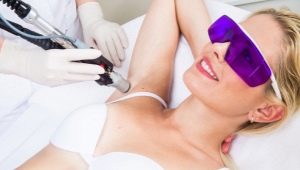 All about laser hair removal using Moveo technology