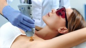 All about underarm hair removal