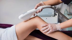 All about laser hair removal
