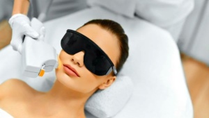 All about photo epilation on the face
