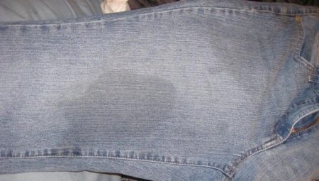 How to remove greasy stains on jeans?