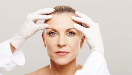 Facelift: the need for a procedure and rules for
