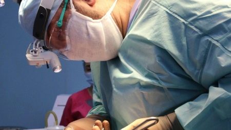 Features of the endoscopic face lifting procedure
