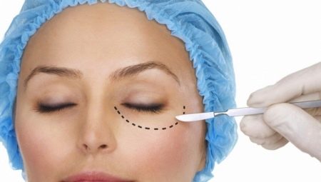 The process of performing blepharoplasty of the lower eyelids