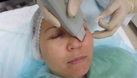 Rules for conducting ultrasonic face cleansing
