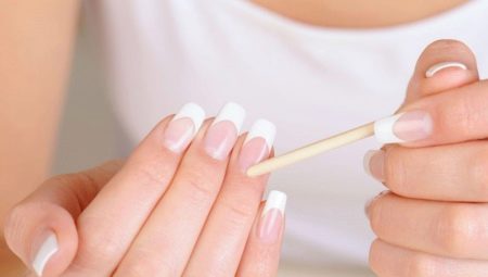 Matrice d'ongles: description, structure et causes des dommages