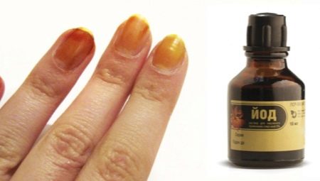 Iodine for nails: from influence to use