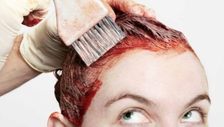 Hair dye allergy