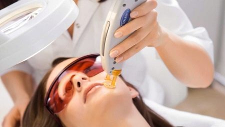 Review of professional laser epilators