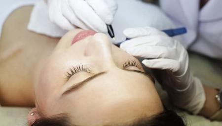 All about electrolysis