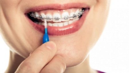All About Teeth Brushes