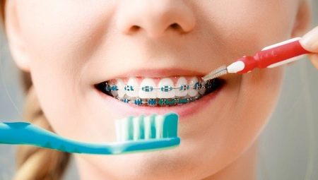 All About Toothbrushes for Braces