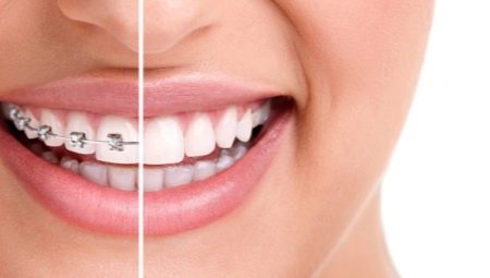 Superfloss: purpose and rules of use