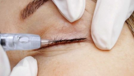 What is inter-eyelash tattooing and how is it done?