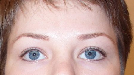 Lower eyelid tattoo