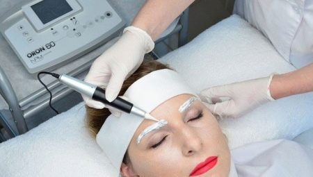 Removal of tattoo with a remover