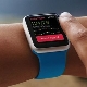 Smart bracelet with heart rate and pressure measurement