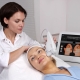 Features of the Ulthera System SMAS lifting