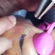 Subtleties of the process of laser eyebrow tattoo removal