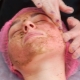 Coral peeling: what is it and how to care for your face after?