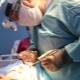 Features of the endoscopic face lifting procedure