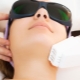 Laser peeling: description of the procedure, benefits and harms from it