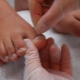 Toenails growing up: causes and treatments