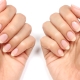 Flaky nails: causes, treatment and prevention