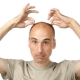 Peladophobia: symptoms and treatment