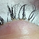 Unsuccessful eyelash extension: causes and consequences