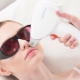 Epilation of the upper lip: methods and rules