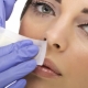 Facial hair waxing