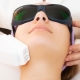 All about facial hair removal