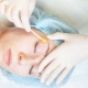 All about epilation