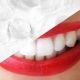 How to whiten teeth with foil?