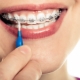 All About Teeth Brushes