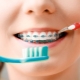 All About Toothbrushes for Braces