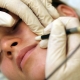 All about facial electrolysis