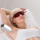 What is photoepilation and how is it done?