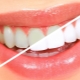 How to whiten teeth at home?
