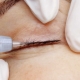 What is inter-eyelash tattooing and how is it done?
