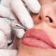Correction of permanent lip makeup