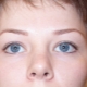 Lower eyelid tattoo