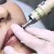 All about lip tattoo removal